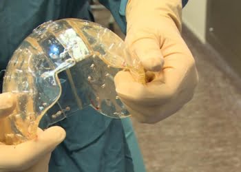 Tecnología «salvavidas» Las impresoras 3D en la salud