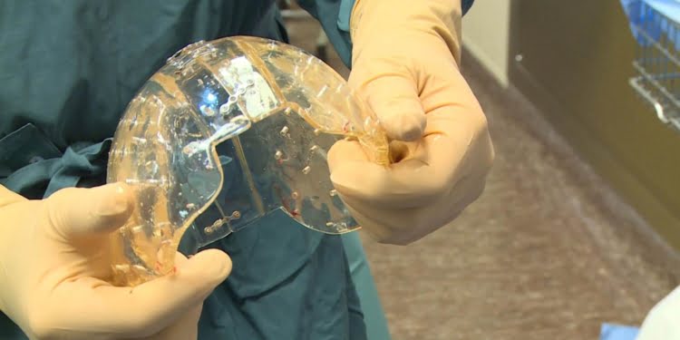 Tecnología «salvavidas» Las impresoras 3D en la salud