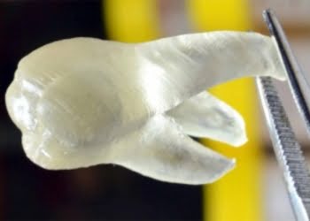 Imprimen dientes en 3D que eliminan las bacterias de la boca