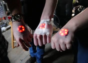 #CURIOSO: Se implantan luces led bajo la piel