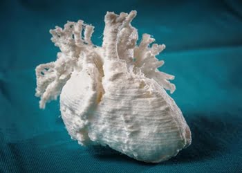 3D: Una réplica de un corazón impresa en 3D salvó la vida a un bebé