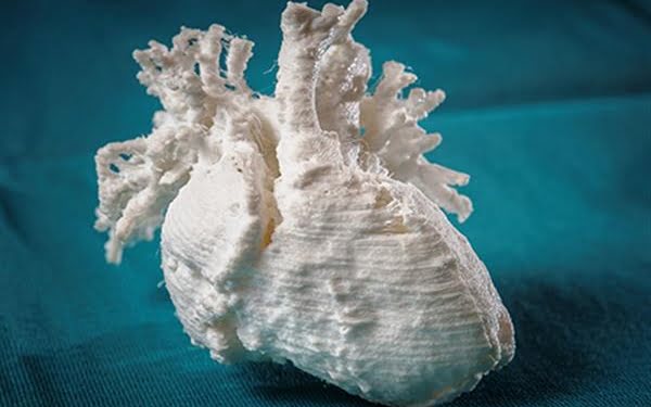 3D: Una réplica de un corazón impresa en 3D salvó la vida a un bebé