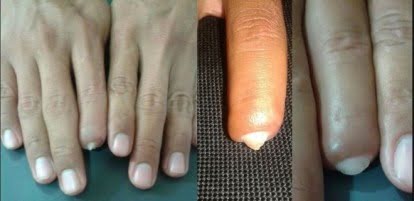 3D: Logran regenerar órganos humanos con impresión 3D